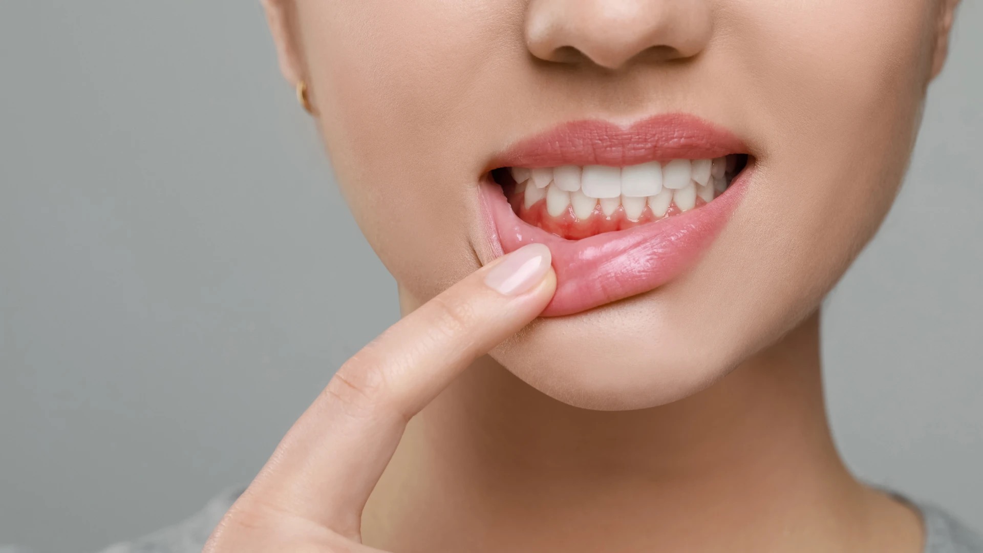 TMJ and Myofunctional Therapy